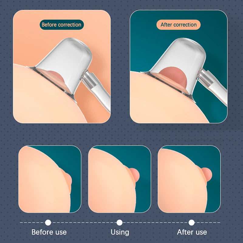 Nipples Aspirator Corrector